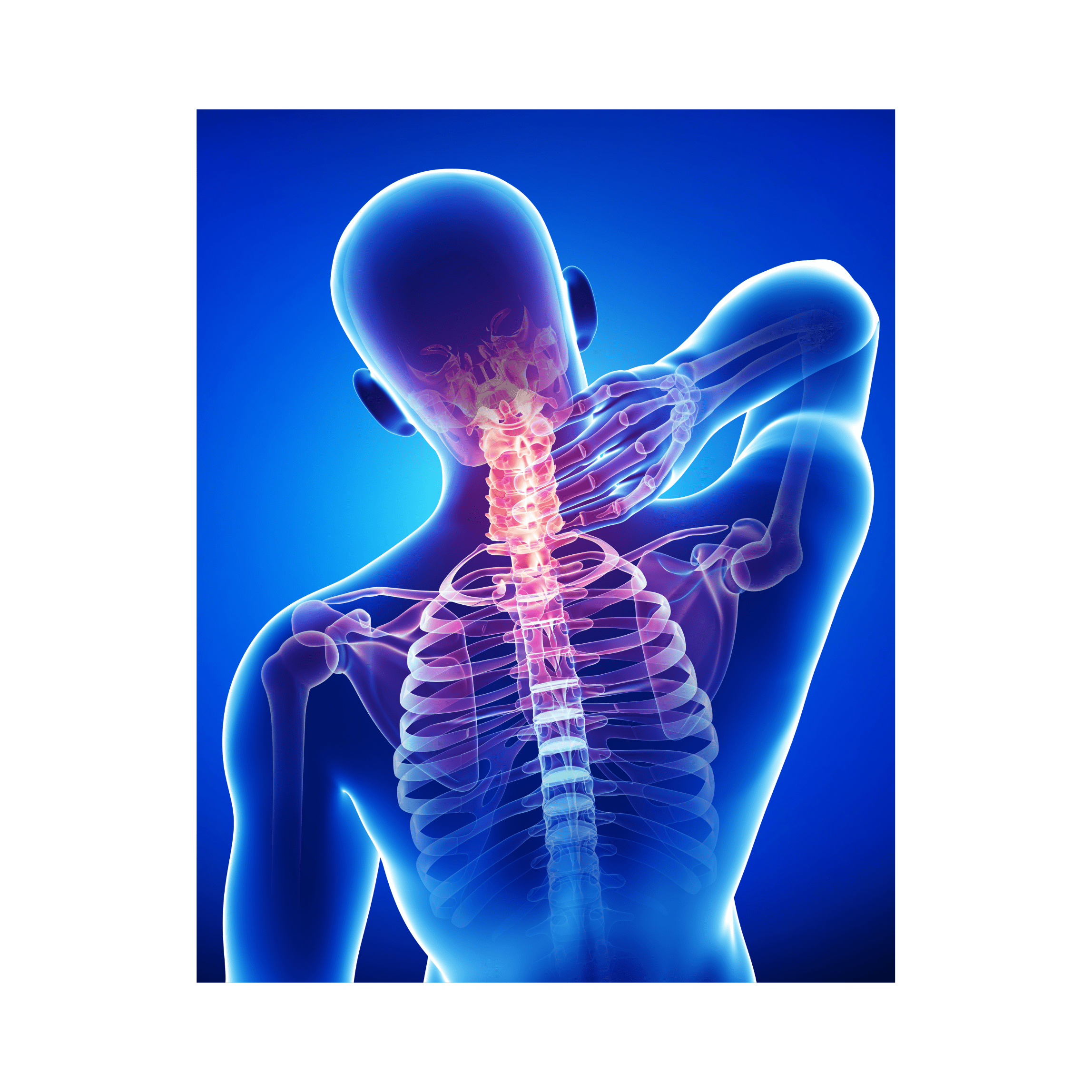Cervical Stenosis