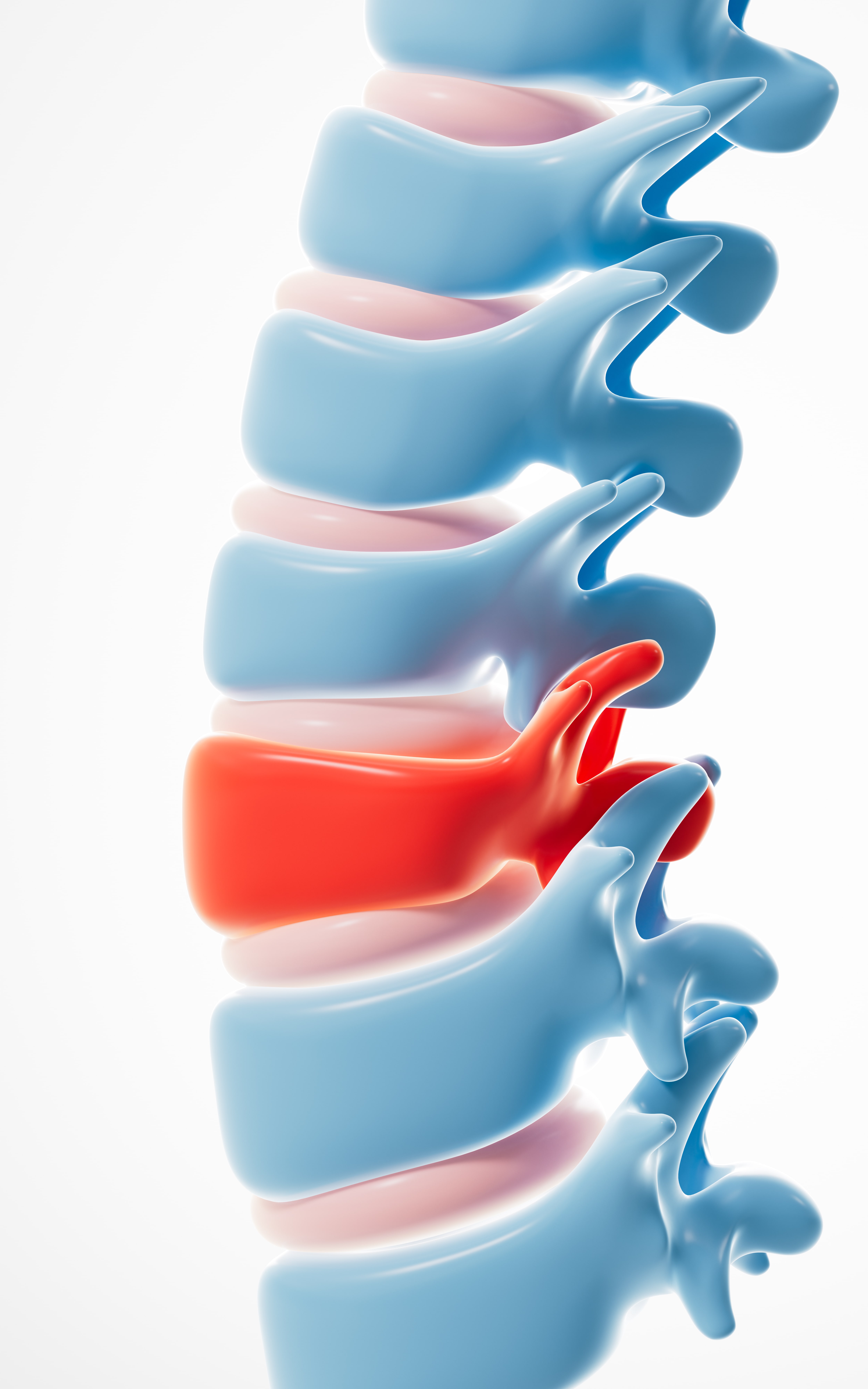 Muscle Strain